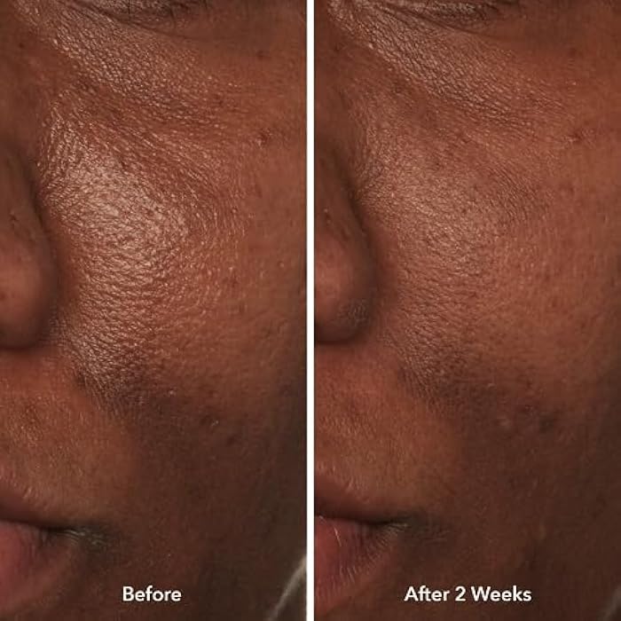 Beekman 1802 Potato Peel - 0.5 fl oz - Fragrance Free - Rapid Resurfacing Milk Facial - At-Home Peel - Visibly Reduces Appearance of Fine Lines & Dark Spots - Good for Sensitive Skin - Cruelty Free - Image 4