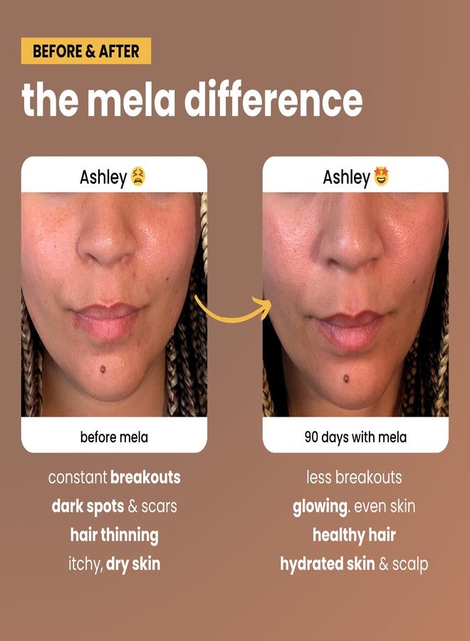 Mela Daily Glow for Healthy Melanin-Rich Skin & Textured Hair – with Silica, Millet, Pumpkin Seed, Probiotics, Hyaluronic Acid & Vitamin D3 – Vegan, Biotin-Free, Gluten & Soy-Free – 60 Count - Image 3