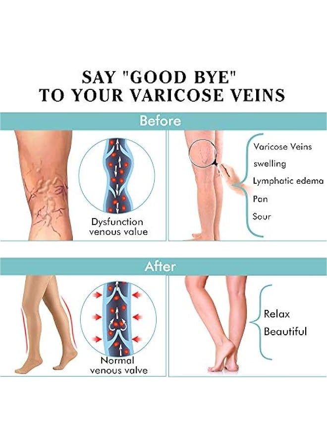 جوارب ضاغطة للنساء بضغط 20-30 ملم زئبقي لعلاج الدوالي (بيج، XL) - Image 2