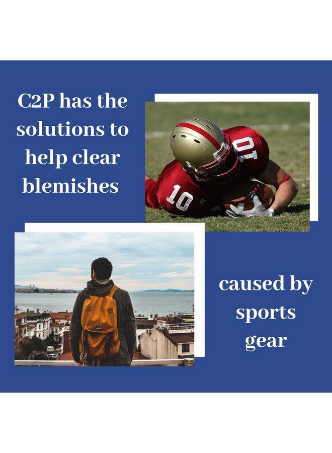 C2P علاج حب الشباب غير كوميدوغيني الواضح 2 الكمال للوجه والجسم وشعر حبوب الشباب غسول مجموعة كاملة ثلاثية خالية من البارابين للشامبو والبلسم ومقشر للتقشير لبشرة طبيعية خالية من العيوب - Image 4