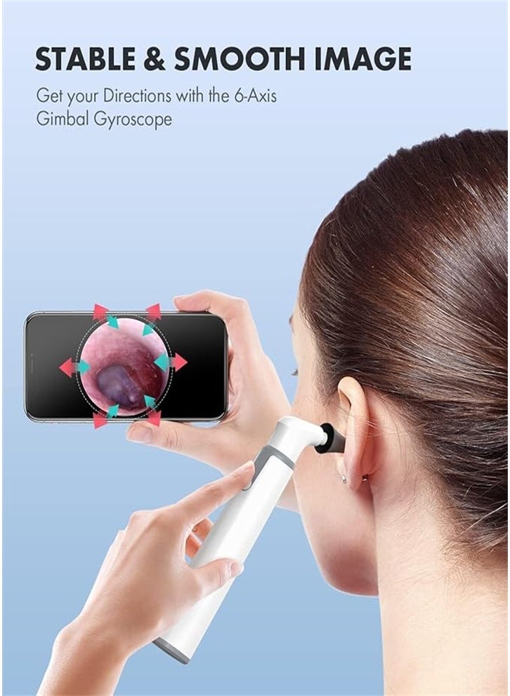 Generic Multifunctional Wireless Otoscope, Otoscope with 720P HD Ear Camera and 6 LED Lights, Earwax Removal Tool Camera with Gyroscope, Can Also See Oral Cavity, Compatible with Android and iPhone  - Image 5