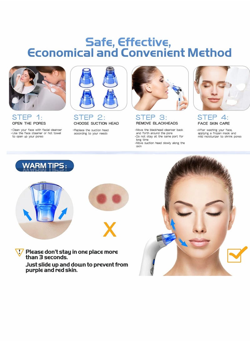 SYOSI - Blackhead Remover Pore Vacuum - Facial Pore Cleaner - Electric Acne Comedone Whitehead Extractor Tool w/5 Suction Power, 4 Probes, USB Rechargeable Blackhead Vacuum Removal Kit for Women & Men (Blue) - Image 1