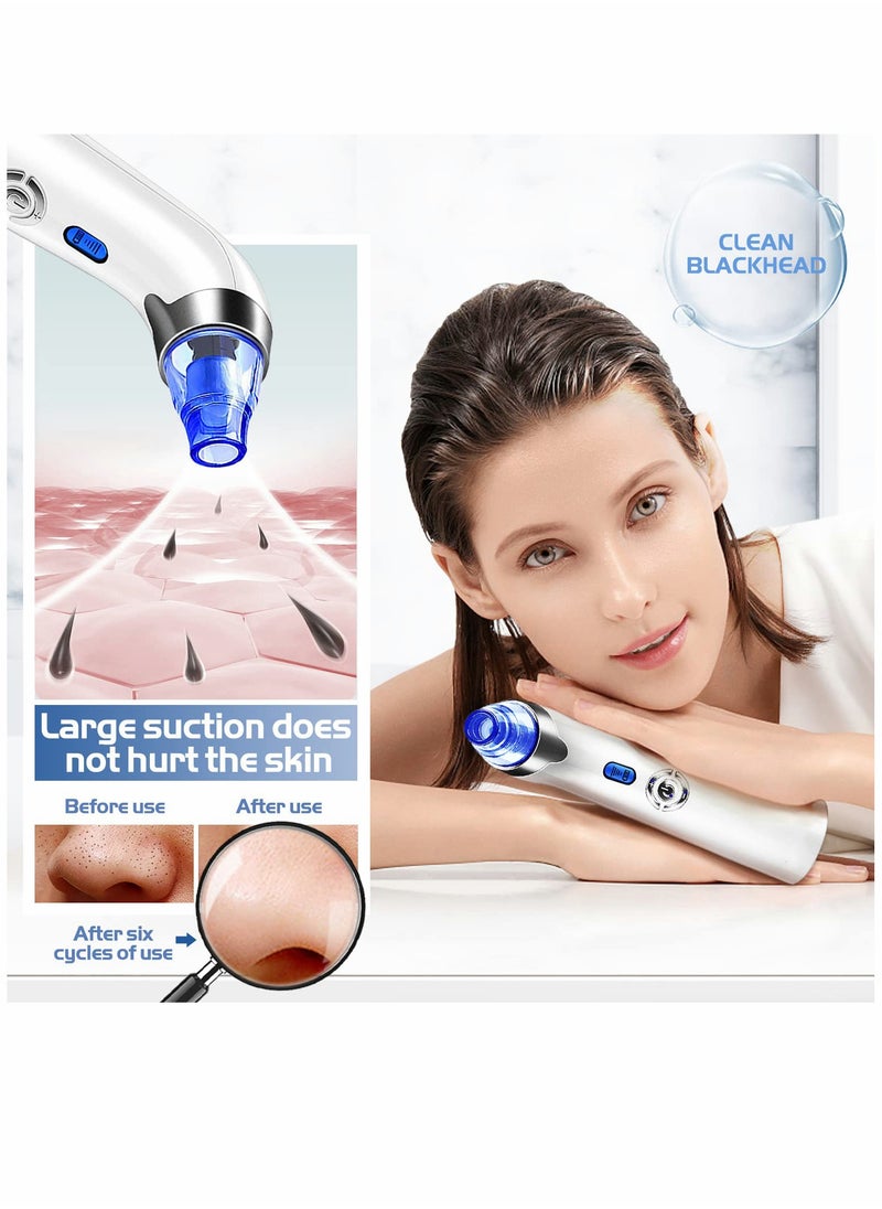SYOSI - Blackhead Remover Pore Vacuum - Facial Pore Cleaner - Electric Acne Comedone Whitehead Extractor Tool w/5 Suction Power, 4 Probes, USB Rechargeable Blackhead Vacuum Removal Kit for Women & Men (Blue) - Image 1