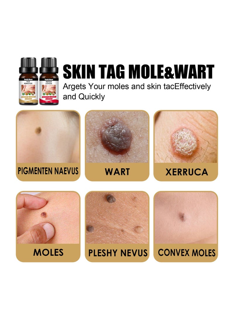 Skin Tag Mole And Wart 10ml+10g