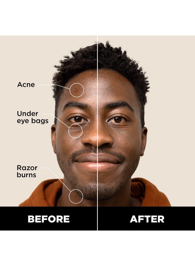 Stryx Concealer Stick Tool For Men Dark Eclipse Natural Pigments Hides Imperfections Acne Razor Burns Scars & Rosacea Highly Adaptable Shades For Easy Undetectable Coverage All Skin Tones - Image 2