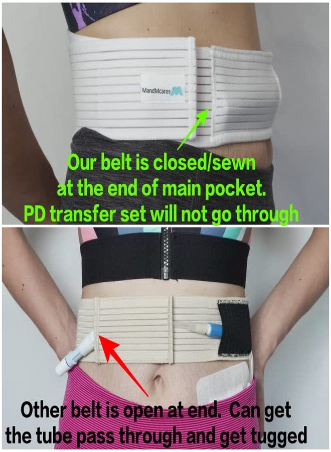 MandMcares Peritoneal Dialysis Breathable PD Catheter Belt | Secure Peg Tube Feeding Holder | Supplies for PD Dialysis Men and Women, White, Large - Image 2
