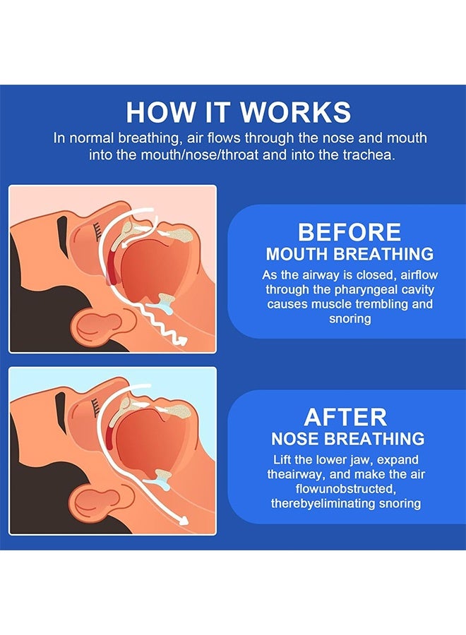 قطعة واحدة من جبيرة مضادة للشخير فعالة لمنع الشخير للرجال والنساء، جبيرة فم عالية الجودة ضد الشخير بديلاً عن موسعات الأنف وبقع الأنف مع صندوق تخزين - Image 3