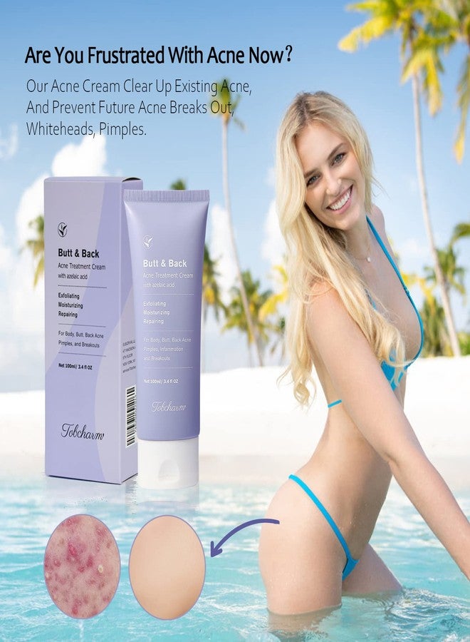 Tobcharm Butt Acne Clearing Treatment, Maximum Strength Body Cream for Back, Buttocks, Thigh & Chest Acne Removal, Skin Clearing Lotion for Men & Women, Foaming Cleanser for Bacne & Cystic Acne - Image 2