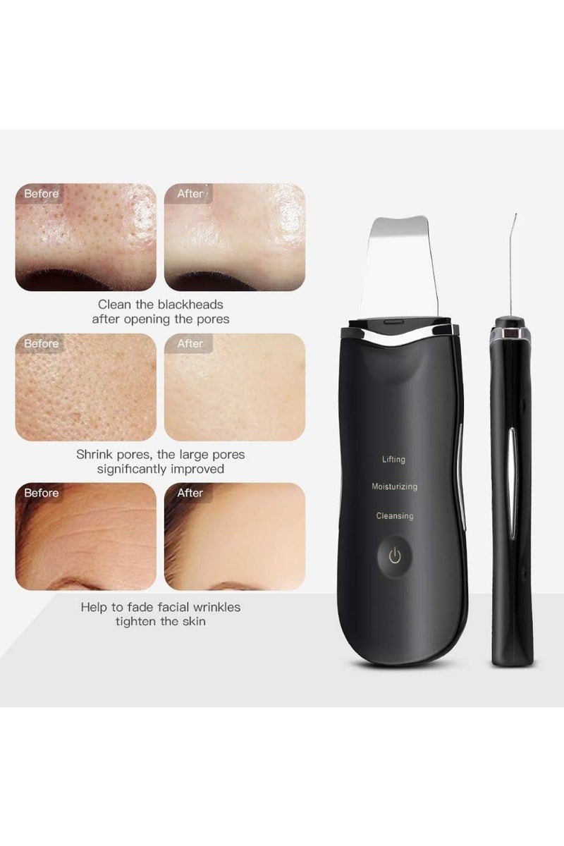 Face Spatula Deep Ion Cleansing Exfoliating Scraper Rechargeable Beauty Massager, Blackhead Remover Acne Peeling Lifting Care Skin Device Black - Image 4