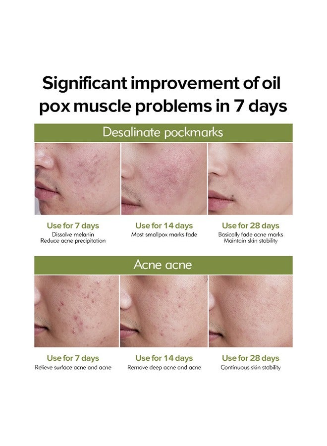 BIOAOUA Salicylic Acid Acne Removal Cream , Acne Treatment Face Cream, Acne Spot Treatment for Face & Acne Dots, Natural Cystic Acne Treatment, For All Skin Types, Premium Acne Scar Cream & Pimple Remover 20g - Image 4