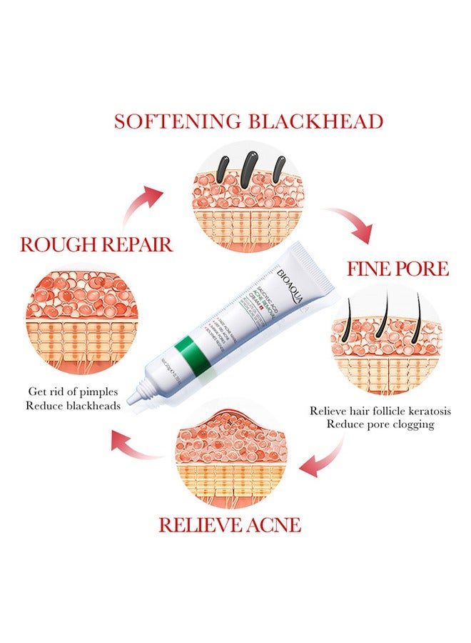 BIOAOUA Salicylic Acid Acne Removal Cream , Acne Treatment Face Cream, Acne Spot Treatment for Face & Acne Dots, Natural Cystic Acne Treatment, For All Skin Types, Premium Acne Scar Cream & Pimple Remover 20g - Image 2