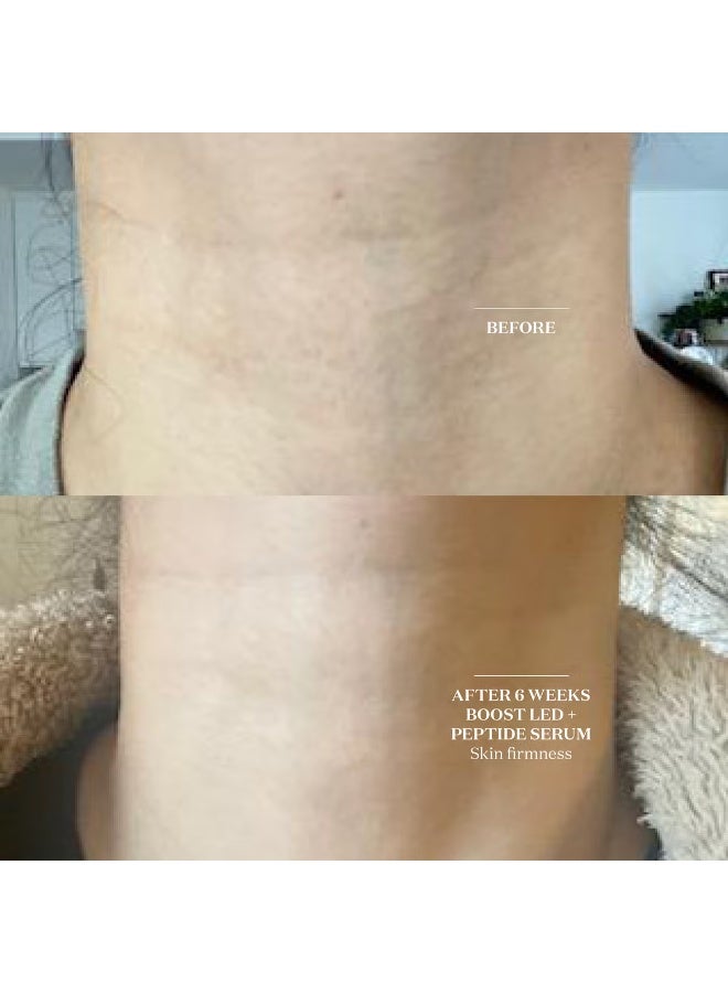 ذا لايت صالون طوق LED المعزز من ذا لايت صالون - Image 2