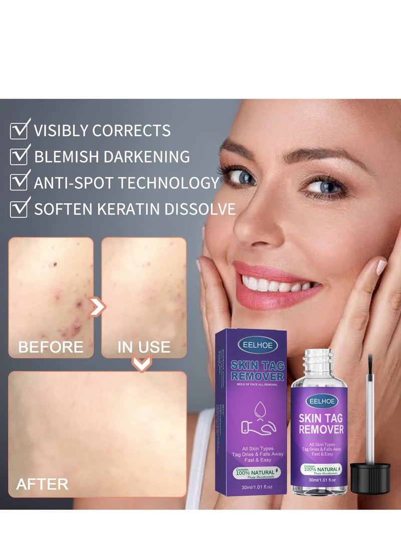 EELHOE mole of face all remova 30ml - Image 2