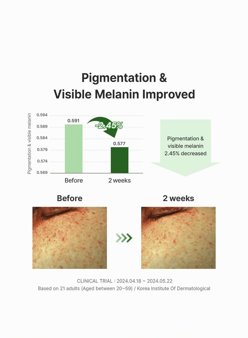 Dr.Althea Vitamin C Boosting Serum & Gentle Vitamin C Serum, Sensitive Skin Free, Even Out Skintone, Good For Pigmentation, Vegan, Korean Skincare (20% Gentle Vitamin C) - Image 3
