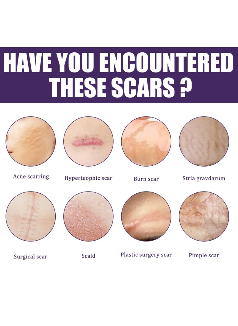 Generic - Silicone Scar Sheets, Professional Silicone Scar Tape, Gel for Scars, Soft Strips for Acne, Keloid, Burns, and C-Section Surgical Scars - Effective Scar Treatment Solution. - Image 1