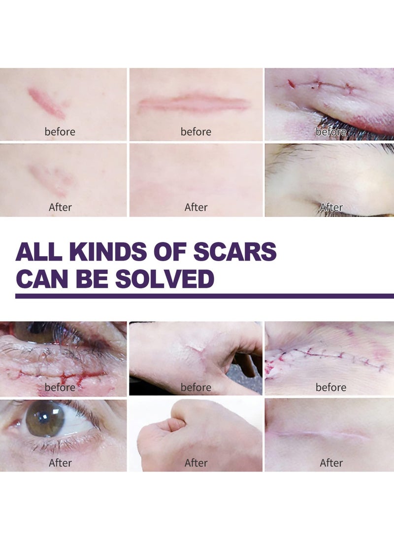Generic - Silicone Scar Sheets, Professional Silicone Scar Tape, Gel for Scars, Soft Strips for Acne, Keloid, Burns, and C-Section Surgical Scars - Effective Scar Treatment Solution. - Image 1