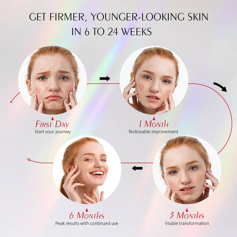 ReLuien Red Light Mask for Face, Silicone Soft LED Face Mask with Remote, 660nm & 850nm Red Light Mask with Timing Function, Reduced Wrinkles, Anti-Aging, at Home (White) - Image 5