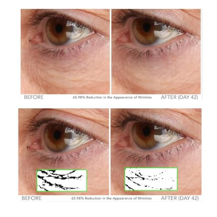 Serious Skincare - Beyond Intensive Vitamin C Serum for Face - 60 Day Facial Treatment for Healthy Glowing Skin and Brightening - Smoothes Lines, Pores and Fades Dark Spots - 2 Piece Anti-Aging Set - Image 5