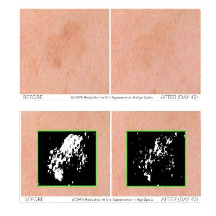 Serious Skincare - Beyond Intensive Vitamin C Serum for Face - 60 Day Facial Treatment for Healthy Glowing Skin and Brightening - Smoothes Lines, Pores and Fades Dark Spots - 2 Piece Anti-Aging Set - Image 3