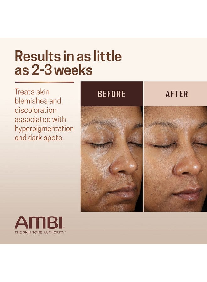أمبي كريم أمبي الموحد والشفاف، خالي من الهيدروكينون، علاج فرط التصبغ، مصحح للبقع الداكنة، نتائج في أقل من 4 أسابيع، نياسيناميد، صبار الألوفيرا، فيتامين سي، 1 أونصة سائلة - Image 4