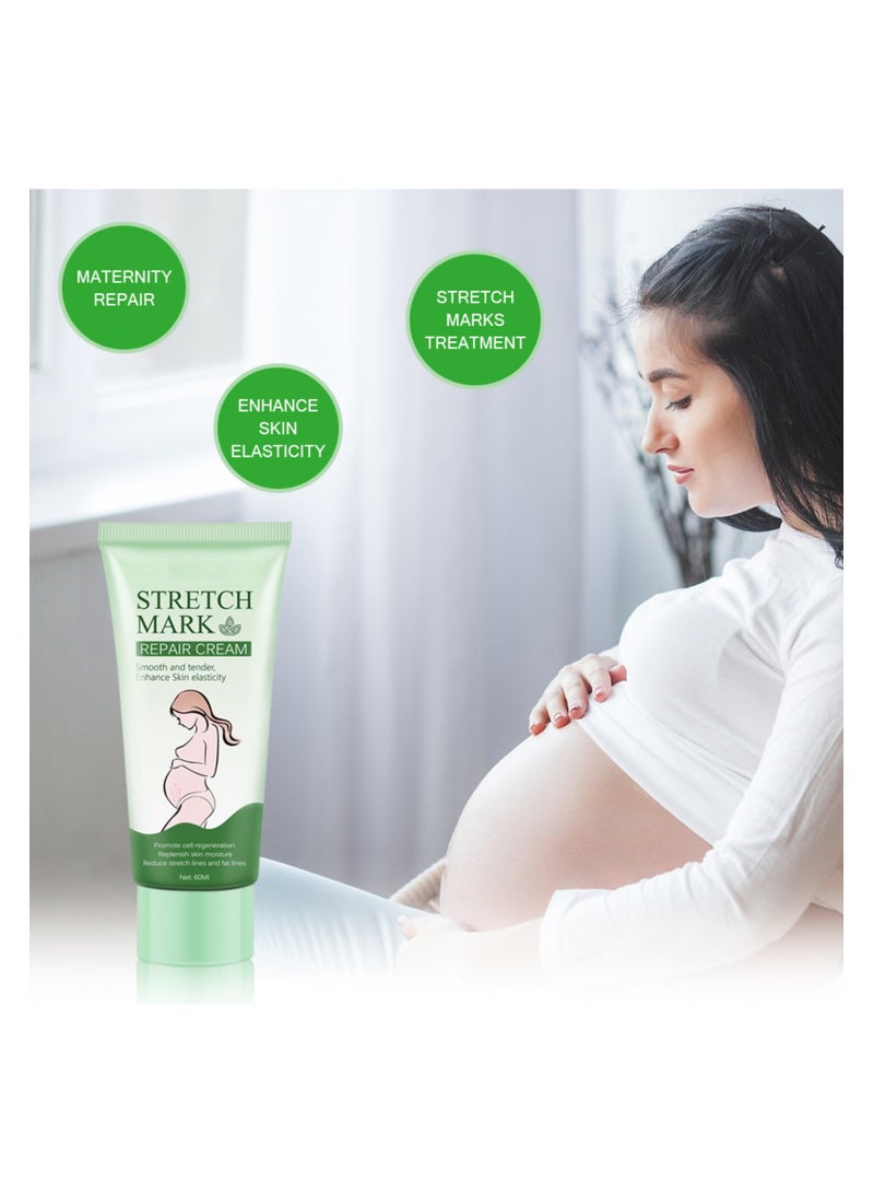 SYOSI Stretch Marks Removal, Pregnancy Stretch Mark Cream, Scar Removal Cream for Stretch Marks for Face Body Scar  - Image 2