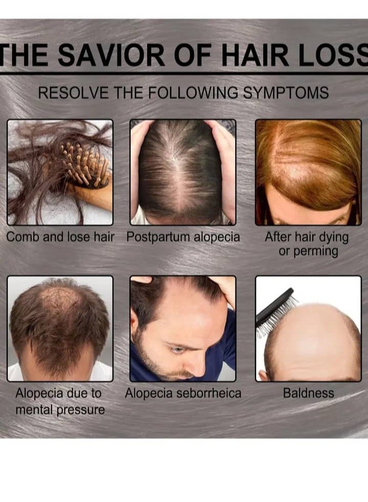 EELHOE Rosemary Essential Oil For Hair Growth Skin Care - Image 4