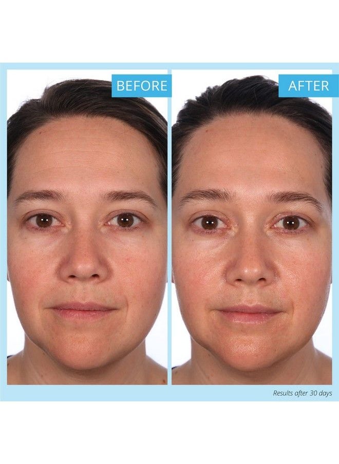 Skinn زيت الوجه المضيء زيت الوجه لتفتيح البشرة وترطيبها بشكل واضح زيت مرطب للبشرة الجافة ومضاد للشيخوخة لتقليل الخطوط الدقيقة والتجاعيد فيتامين سي وعسل مانوكا  - Image 4