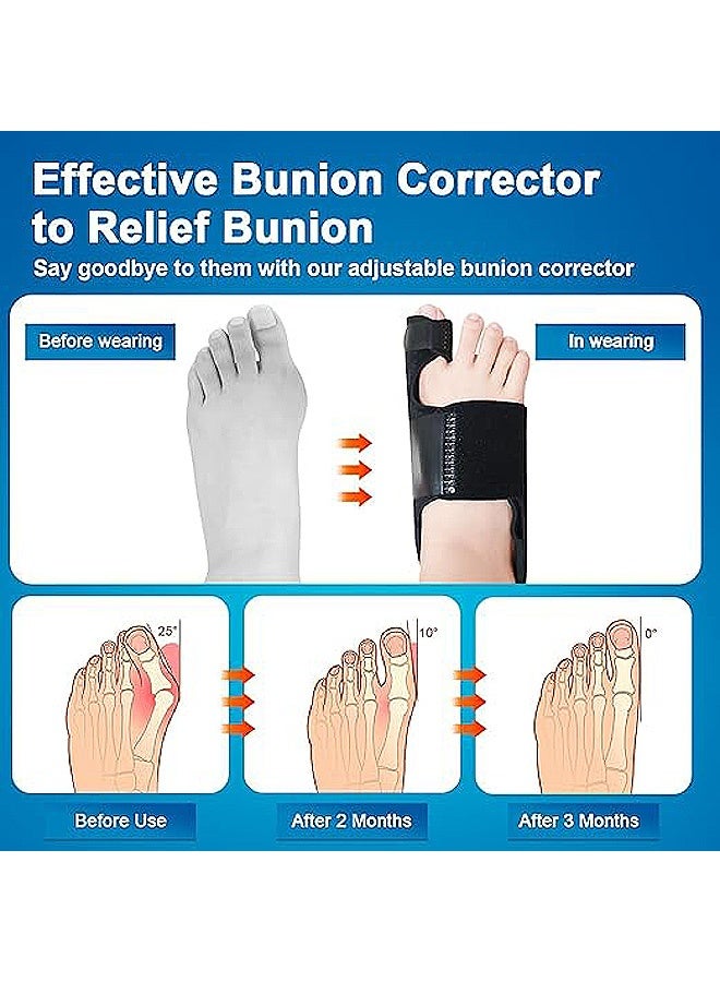 SOUTH MOON Bunion Corrector,  Adjustable Toe Straightener for Men & Women, Straightener Non-Surgical Hallux Valgus Correction Hammer Toe Straightener Corrector (black) - Image 3