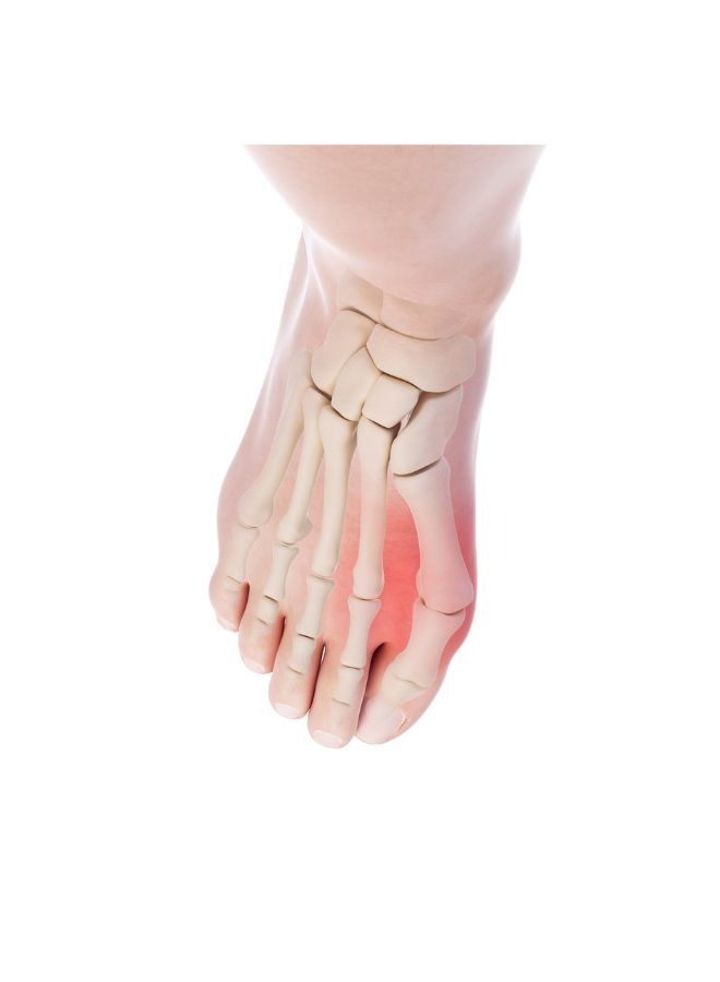 move Toe Separator for Bunions & Foot Pain Relief With Ring MV069 Move - Image 2