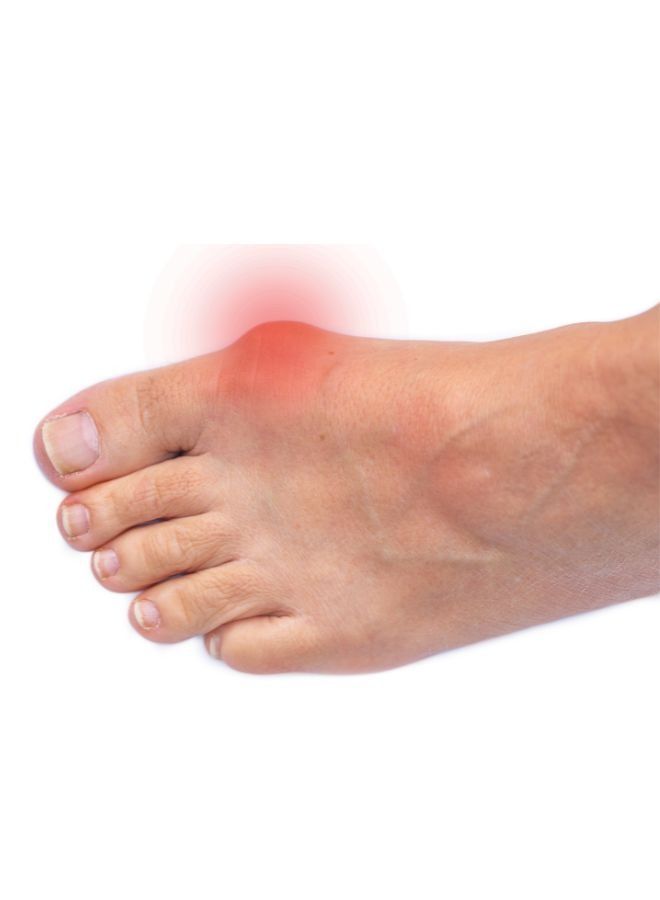 move Toe Separator for Bunions & Foot Pain Relief With Ring MV069 Move - Image 4