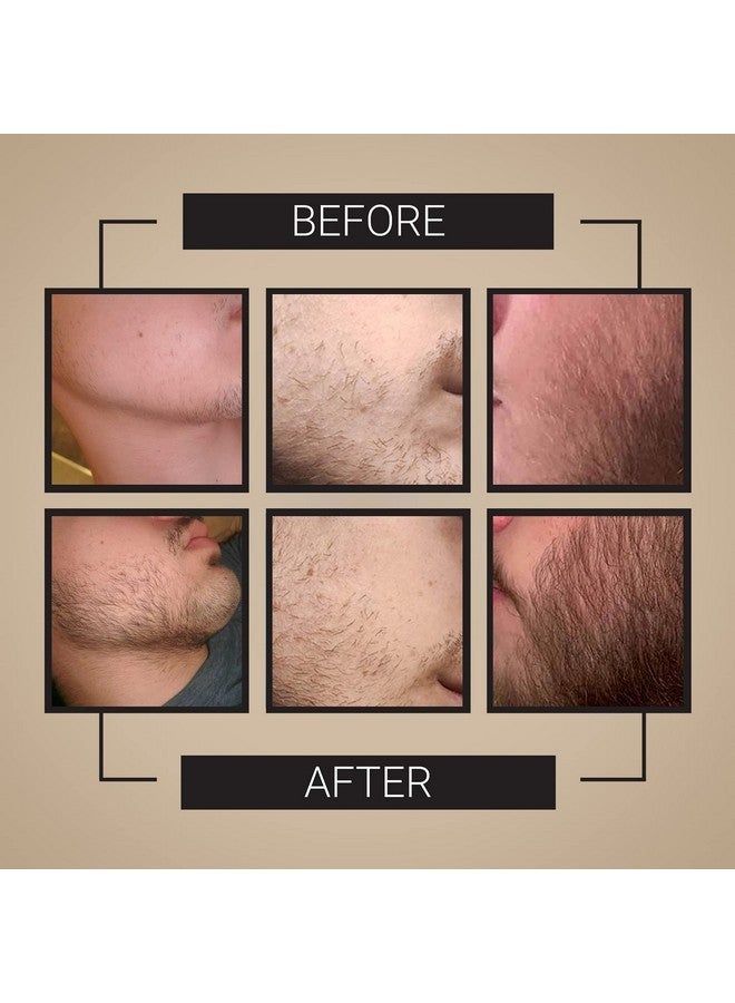 Crafted Beards Beard Growth Kit - Beard Growth Roller - Beard Growth Oil - Beard Roller - Beard Grower - 30 day supply - Image 2