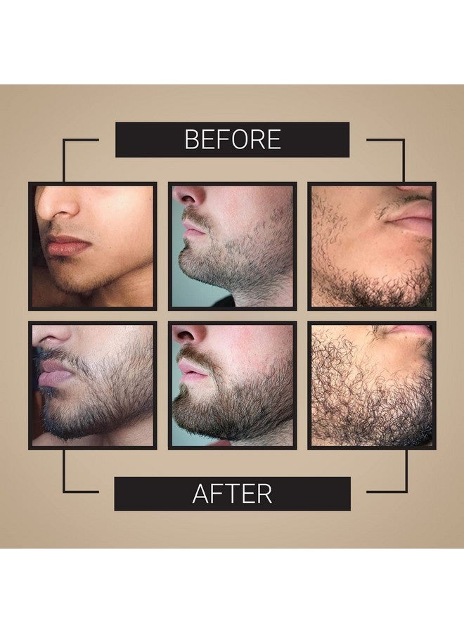 Crafted Beards Beard Growth Kit - Beard Growth Roller - Beard Growth Oil - Beard Roller - Beard Grower - 30 day supply - Image 3