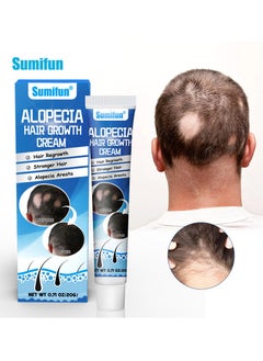 Alopecia Hair Growth Cream for Promote Men's Hair Growth,Prevent Hair Loss,Care for Hair