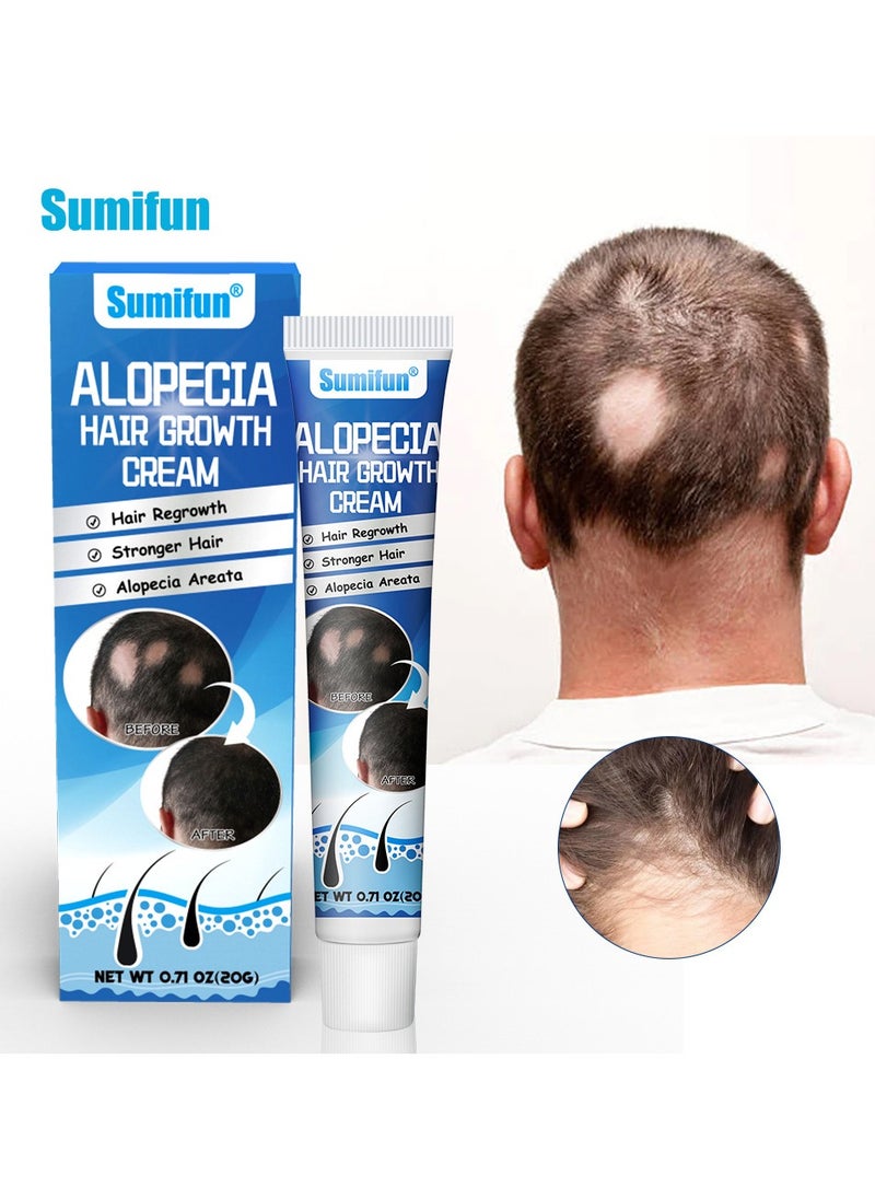 Sumifun - Alopecia Hair Growth Cream for Promote Men's Hair Growth,Prevent Hair Loss,Care for Hair - Image 1