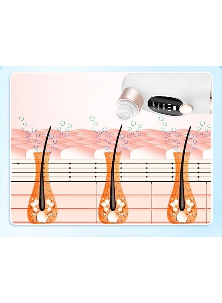 Blackhead Suction Pore Cleaner, 6 Suction Heads, 3 Modes, USB Charging Facial Cleansing, Pick Vacuum Cleaner, Device Blackhead Remover - Image 4