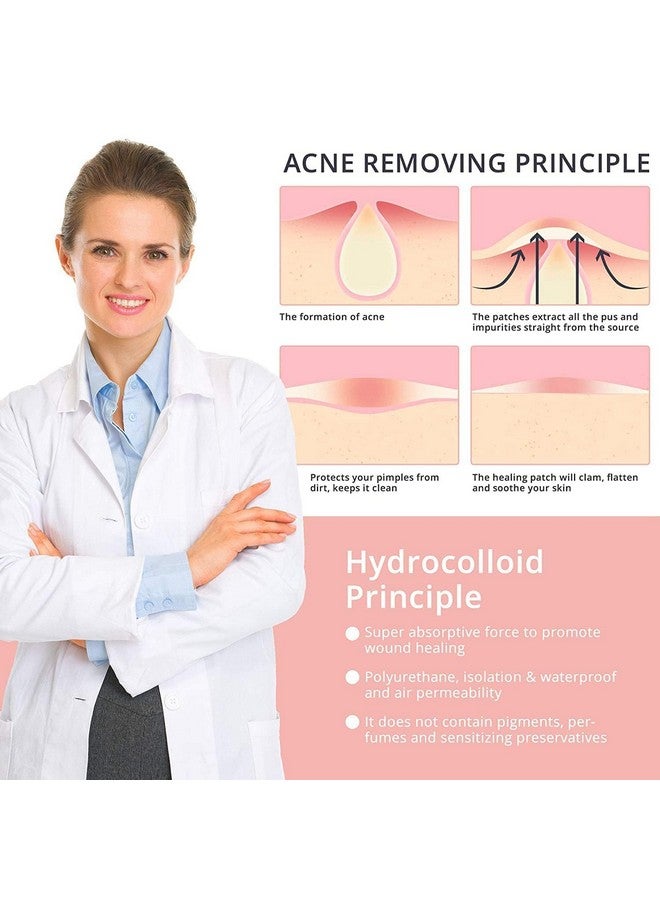 GREEVA Acne Pimple Patches For Face Active Surface Acne Hydrocolloid Waterproof Patches Absorbs Pimple Overnight Reduces Excess Oil Suits All Skin Types. - Image 3