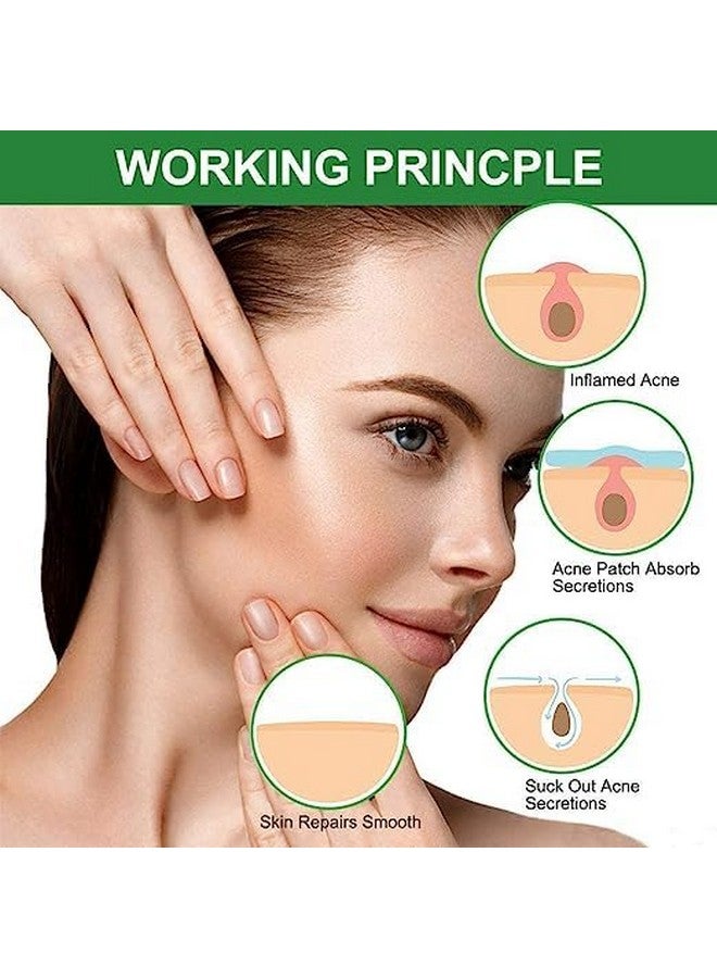 GREEVA Acne Pimple Patches For Face Active Surface Acne Hydrocolloid Waterproof Patches Absorbs Pimple Overnight Reduces Excess Oil Suits All Skin Types. - Image 5