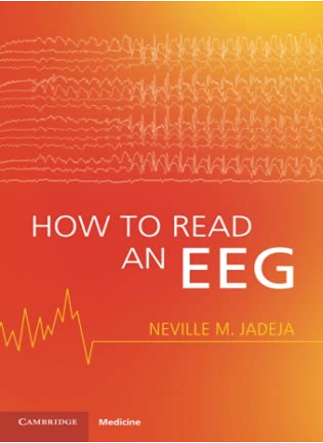 null - How To Read An Eeg - Image 1