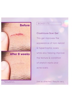 CICATRICURE Cicatricure Face & Body Advanced Scar Gel, Scar Treatment for Old & New Scars, Fades Stretch Marks Away, Surgical Scars, Injuries, Burns and Acne Scar Treatment, For Adults & Kids, 1 oz (28g), 1-Pack  - Image 5