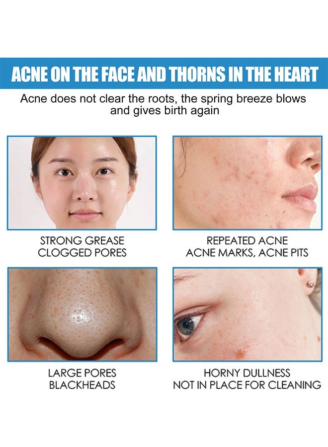 إيلهو كريم B5 المهدئ لإصلاح البشرة، كريم لتقوية حاجز الجلد، كريم وجه ليشد البشرة للبشرة الحساسة، كريم مرطب مضاد لاحمرار البشرة، كريم ترطيب عميق للخطوط الدقيقة والتجاعيد، تحسين مرونة الجلد وثباته، ترطيب مكثف، مرطب للوجه للنساء والرجال 40 مل - Image 4