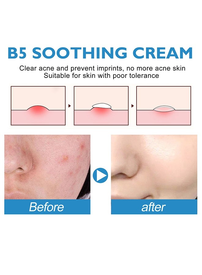 إيلهو كريم B5 المهدئ لإصلاح البشرة، كريم لتقوية حاجز الجلد، كريم وجه ليشد البشرة للبشرة الحساسة، كريم مرطب مضاد لاحمرار البشرة، كريم ترطيب عميق للخطوط الدقيقة والتجاعيد، تحسين مرونة الجلد وثباته، ترطيب مكثف، مرطب للوجه للنساء والرجال 40 مل - Image 5