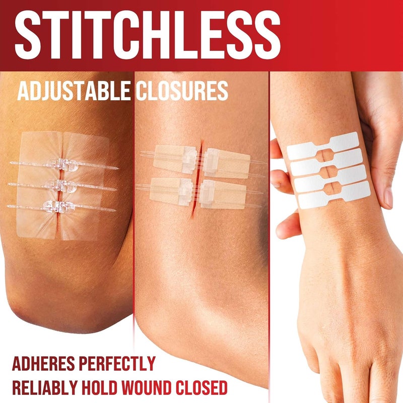 MYHELP Emergency Wound Closure Strips 24pk 3 Types Easy to Use Butterfly Bandages Stitchless Painless Laceration Closure Kit - Image 3