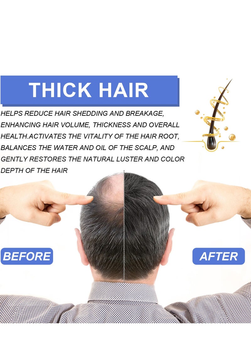 OUHOE - Intense hair growth foam mousse for men - advanced hair growth treatment for thicker hair - hair loss solution - hair growth products for men - Image 1