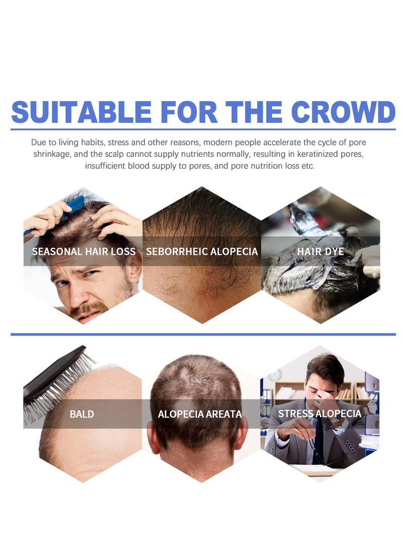 OUHOE - Intense hair growth foam mousse for men - advanced hair growth treatment for thicker hair - hair loss solution - hair growth products for men - Image 1