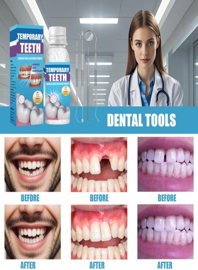 Tampery Tooth Repair Kit, temporary tooth filling kit with 4 Shaping Tools, Dental Care Kit Fixing Broken Teeth, Regain Your Smile - Image 2
