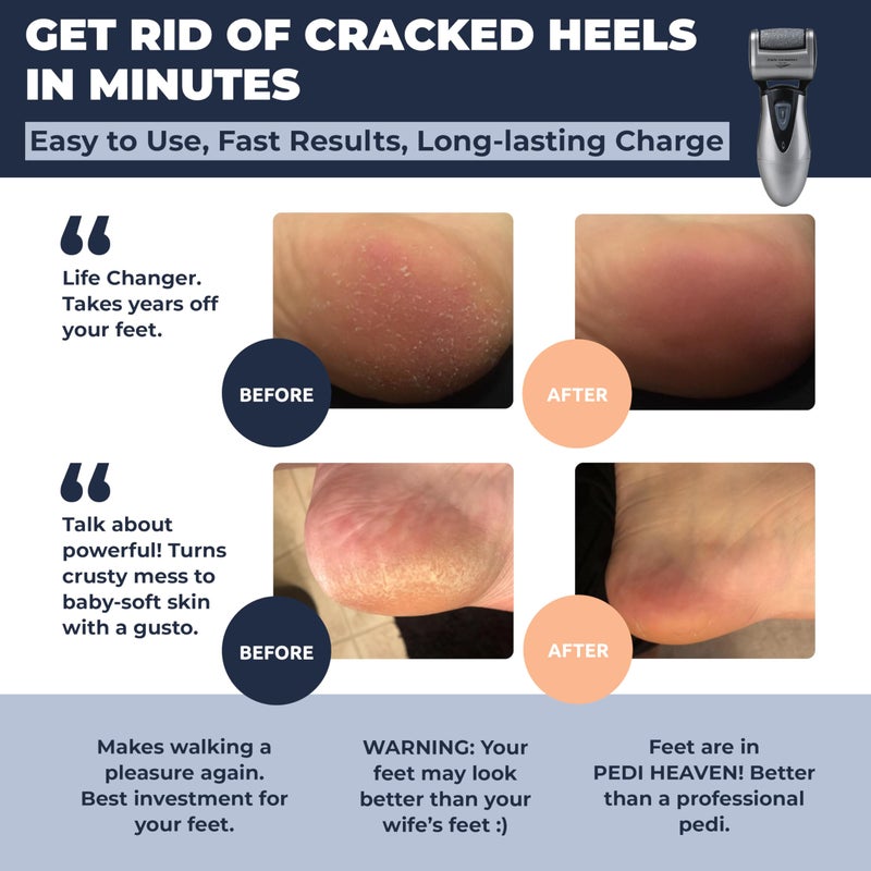 Own Harmony Electric Callus Remover: Rechargeable Electronic Foot File Cr900 By Own Harmony(Tested Most Powerful) Best Pedicure Tools W 3 Rollers Professional Pedi Feet Care Sander For Cracked Heels And Hard Skin - Image 2