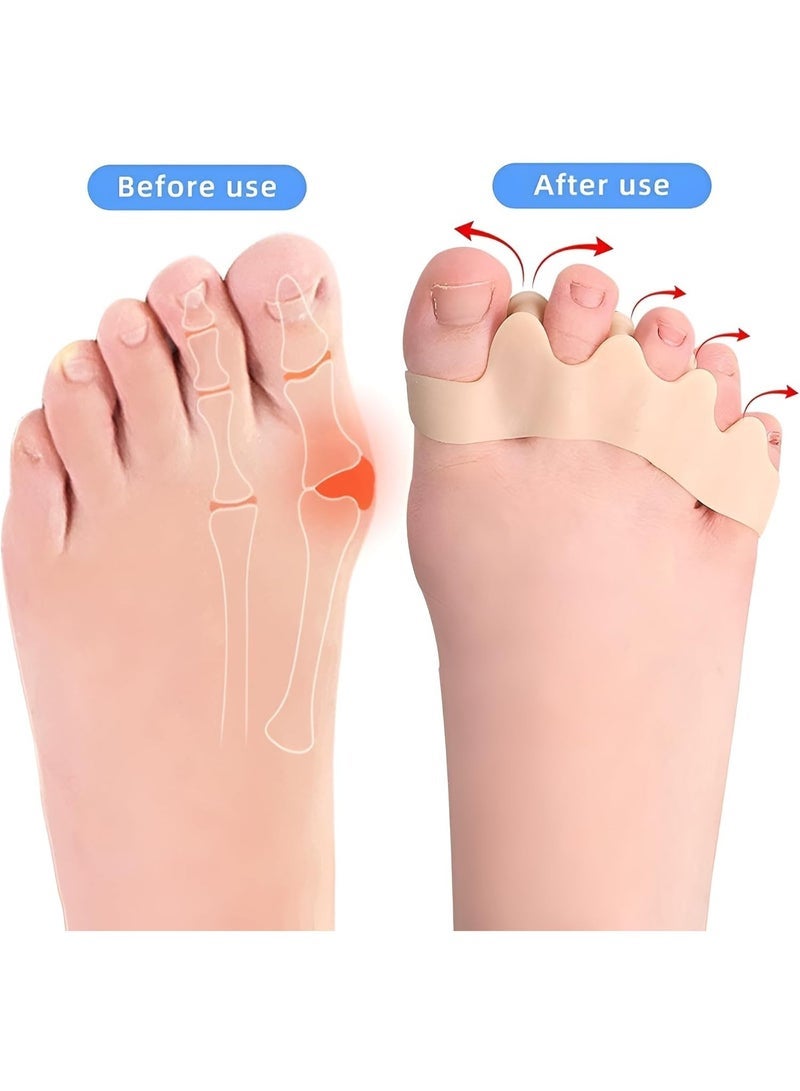 Pair of Medical Silicone Gel Toe Separators - Bunion, Hallux Valgus, and Hammer Toe Corrector - Toe Straightening, Pain and Pressure Relief - Suitable for Men, Women, and Athletes - One Size - Image 4