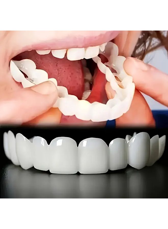 Porcelain Veneer Braces Set Comfort Fit Upper Lower Teeth White - Image 1