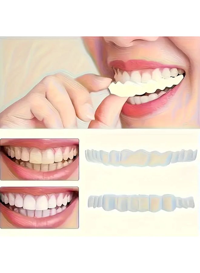 Porcelain Veneer Braces Set Comfort Fit Upper Lower Teeth White - Image 4