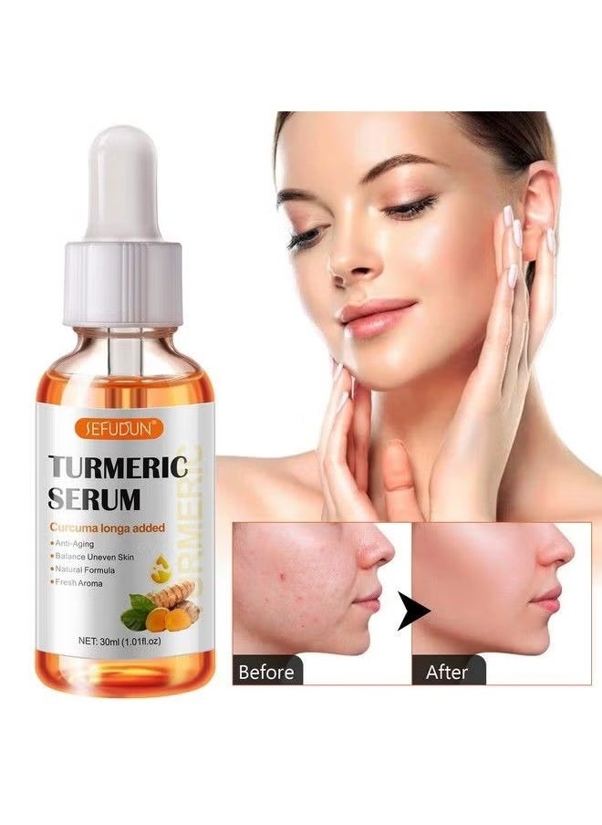 Sefudun - Turmeric Serum for Dark Spots 1 Fl Oz, Turmeric Dark Spot Corrector Serum for Face & Body, Anti Aging Facial Serum for Women and Men, Reduces Hyperpigmentation, Age Spots, Sun Spot, Improve Skin Tone - Image 1